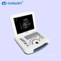 DW-580 price laptop ultrasound, cheap ultrasound equipment